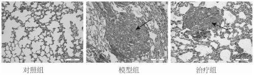 Application of CoQ10 in silicosis fibrosis resistance