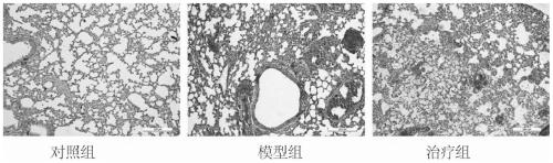 Application of CoQ10 in silicosis fibrosis resistance