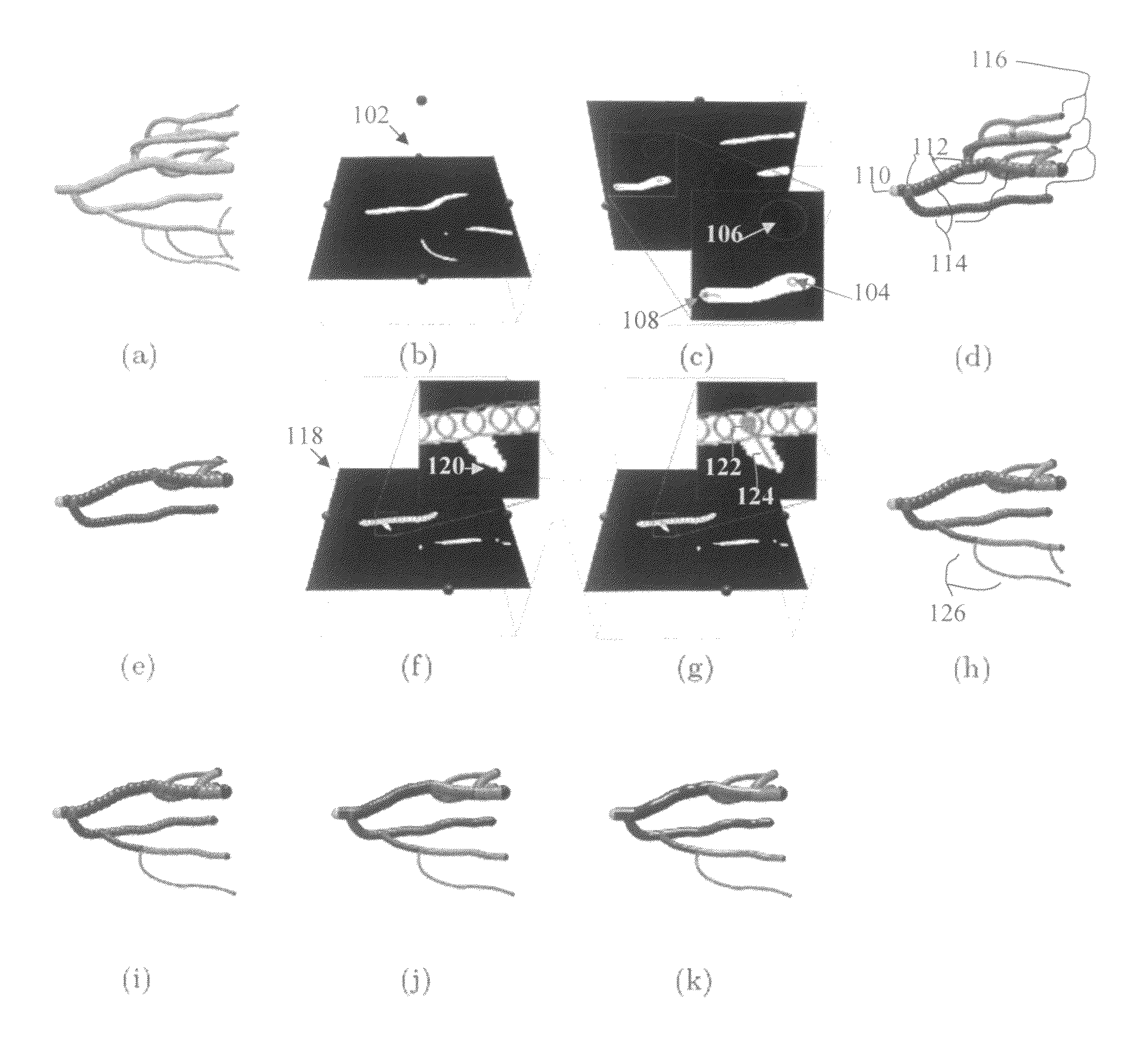 Method and system for segmentation of tubular structures in 3D images