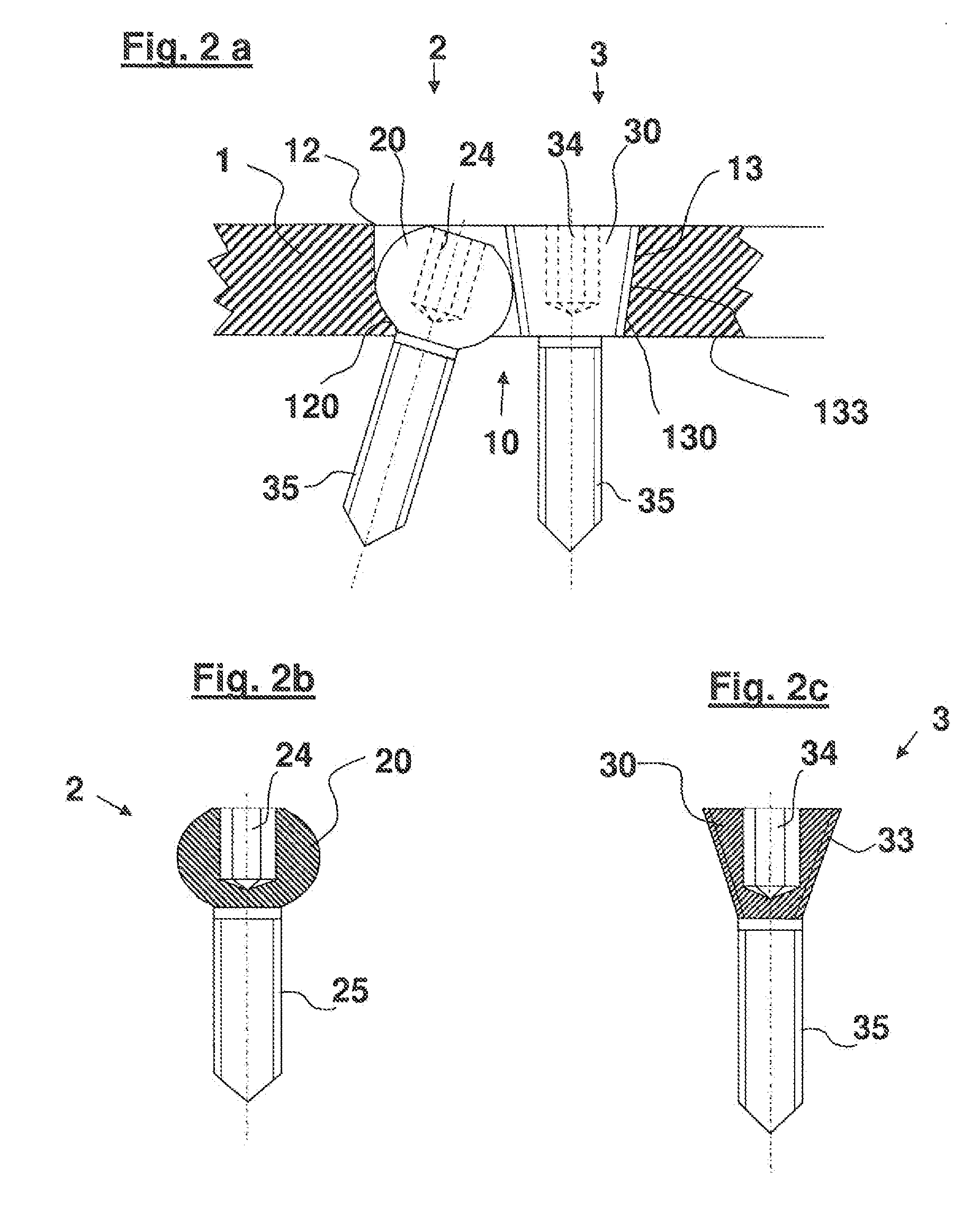 Bone Plate System for Osteosynthesis