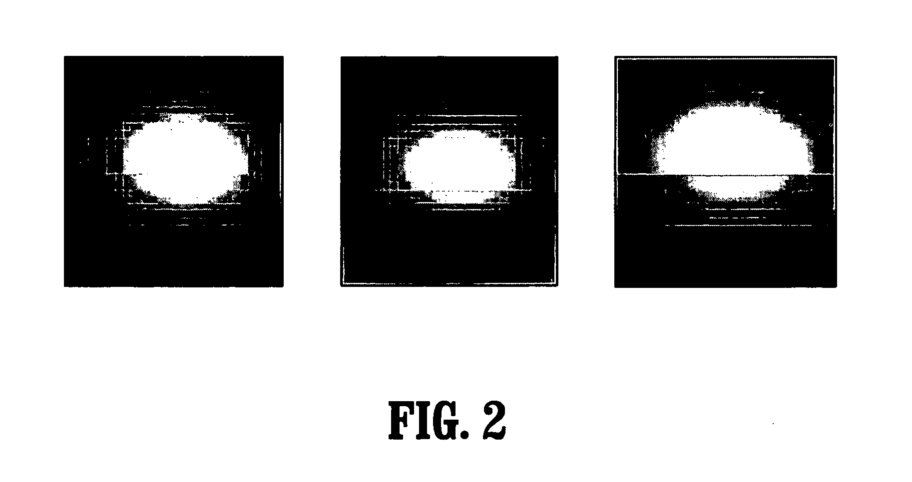 System and method for vascular segmentation by Monte-Carlo sampling