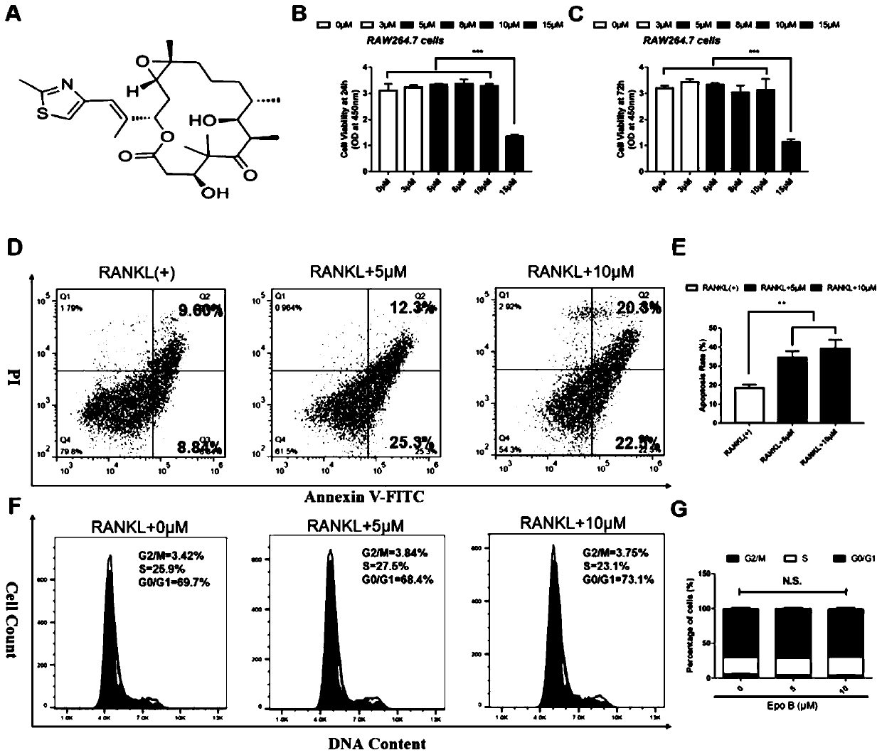 Application of epothilone B in preparing medicine for preventing and treating inflammatory bone loss