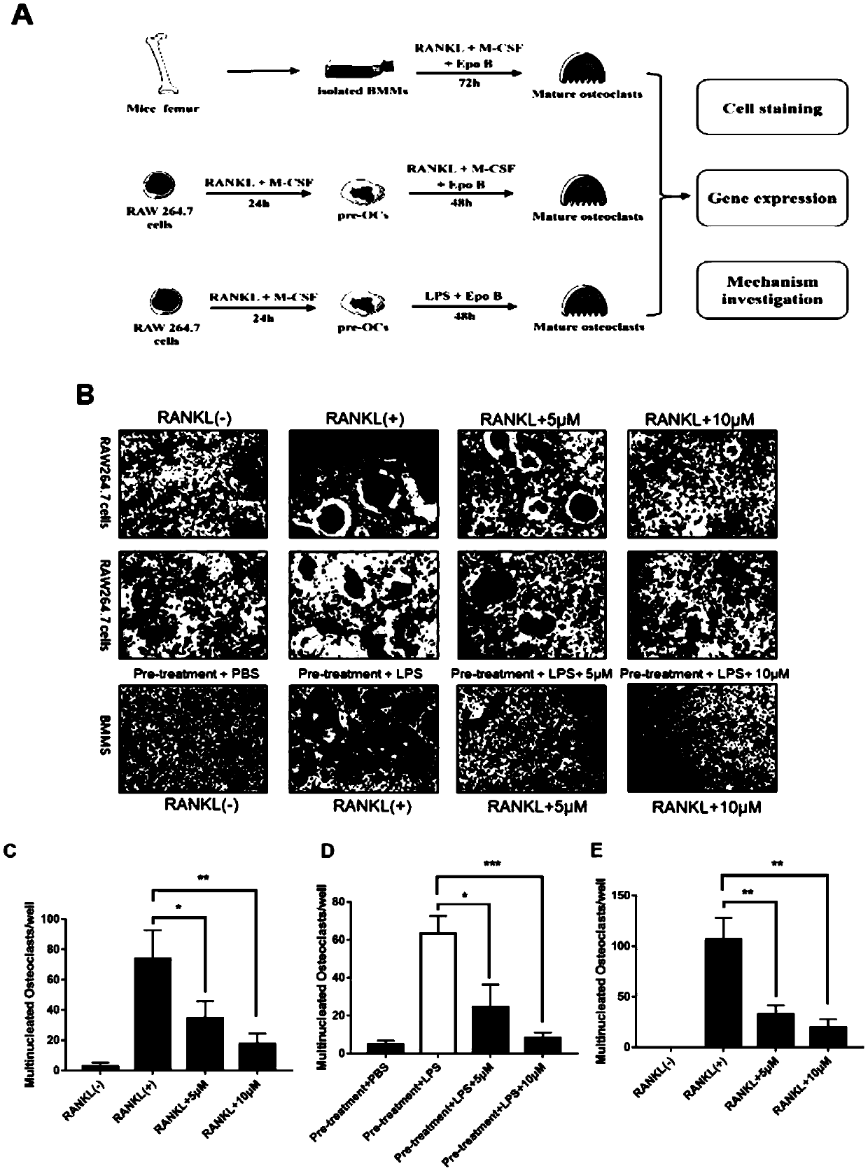 Application of epothilone B in preparing medicine for preventing and treating inflammatory bone loss