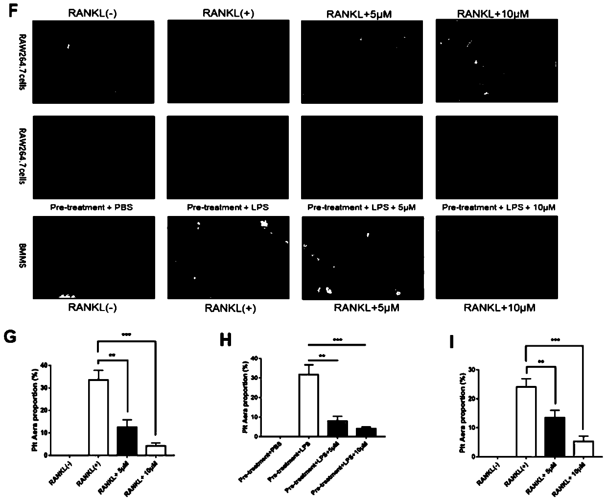 Application of epothilone B in preparing medicine for preventing and treating inflammatory bone loss