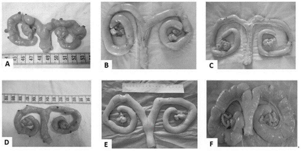 Stem cell composite collagen scaffold kit used for repairing endometrial damage, and preparation method thereof