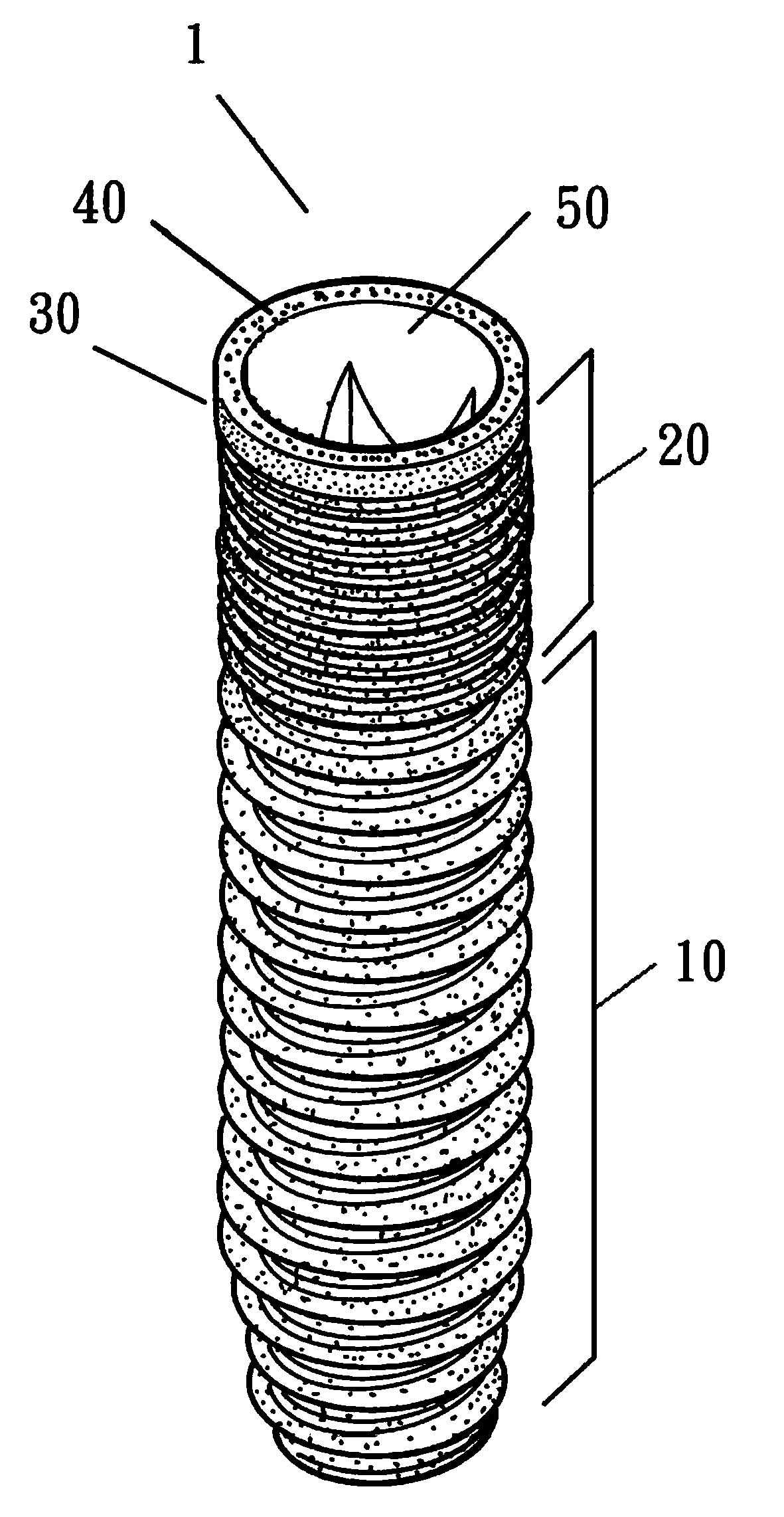 Dental implant having different surface treatment areas