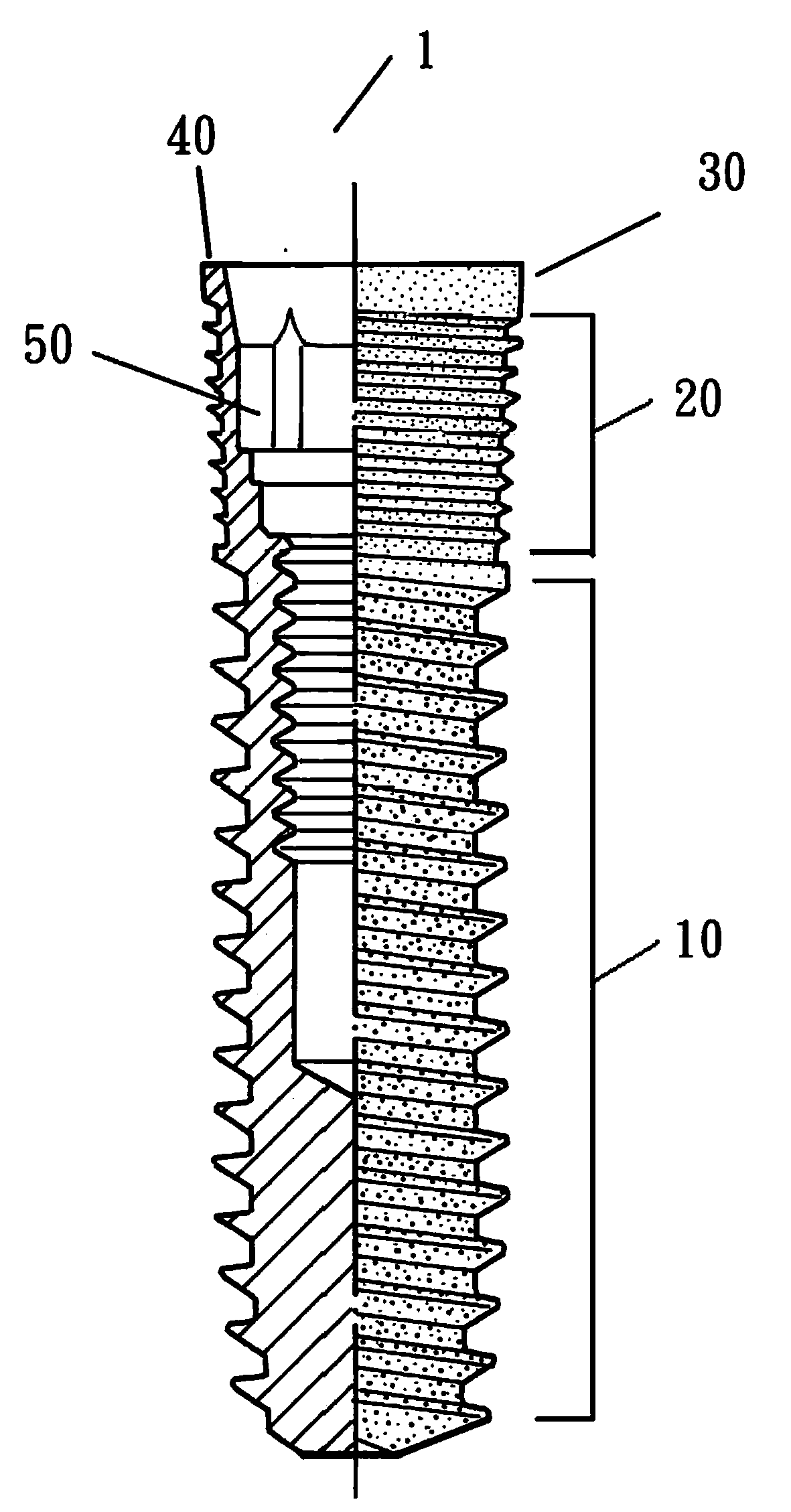 Dental implant having different surface treatment areas