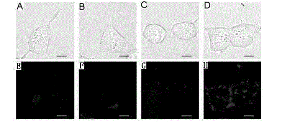 Biotin derivative of phenylephrine and preparation method and application thereof