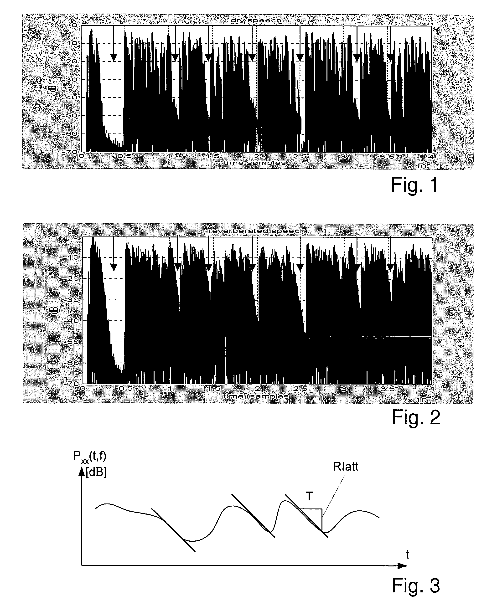 Method of processing an acoustic signal, and a hearing instrument