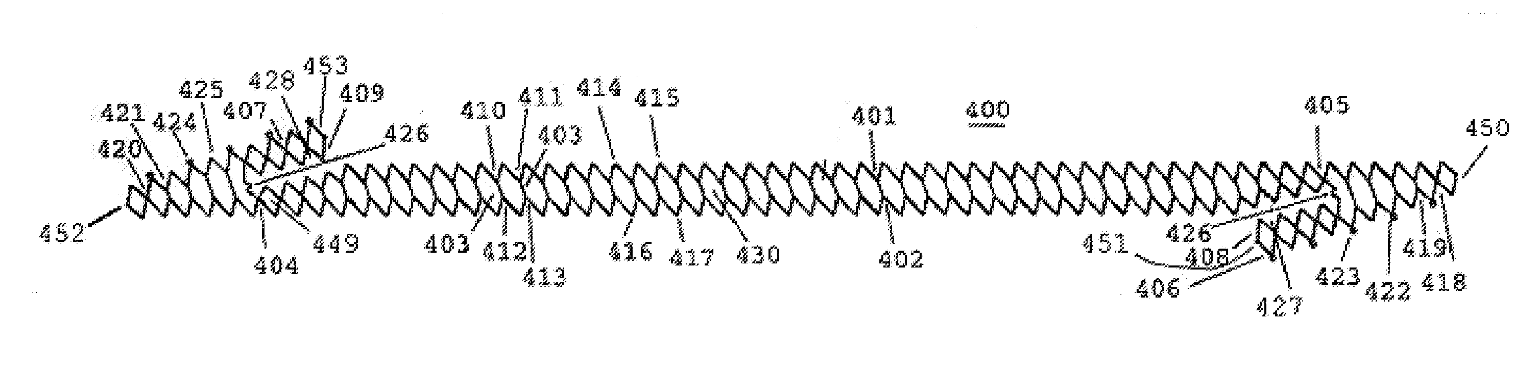 Helical hybrid stent