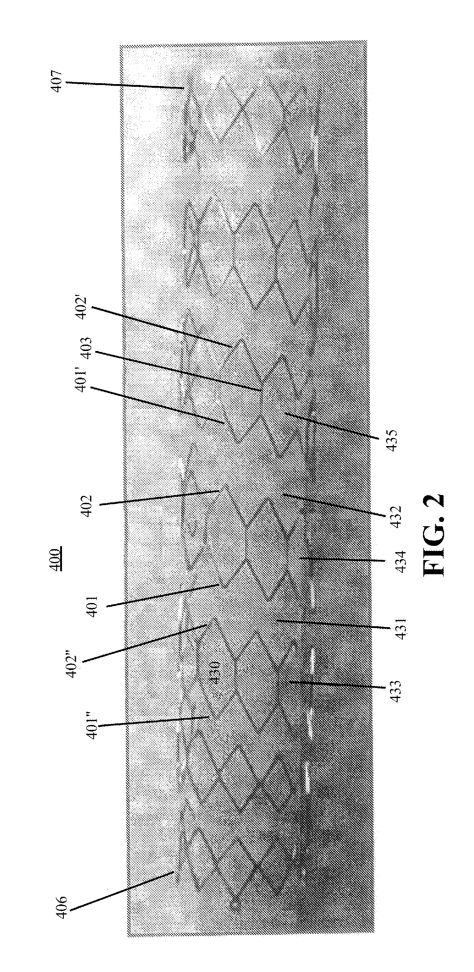 Helical hybrid stent