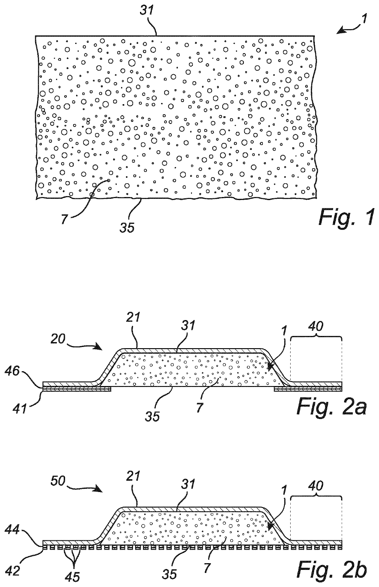 Foam in wound treatment