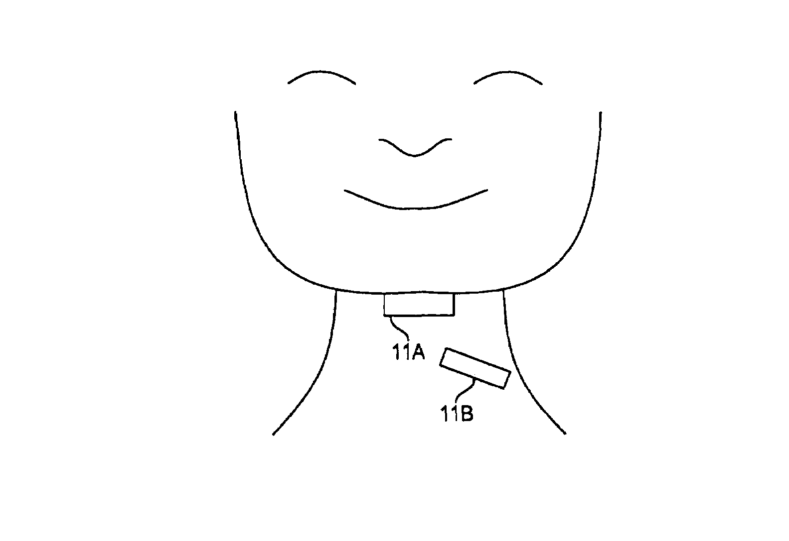 Applications of sub-audible speech recognition based upon electromyographic signals