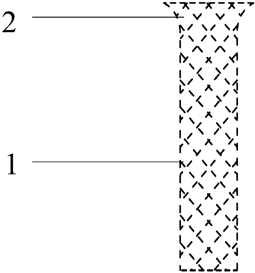 A special main and lateral branch balloon stent system for interventional treatment of bifurcation lesions