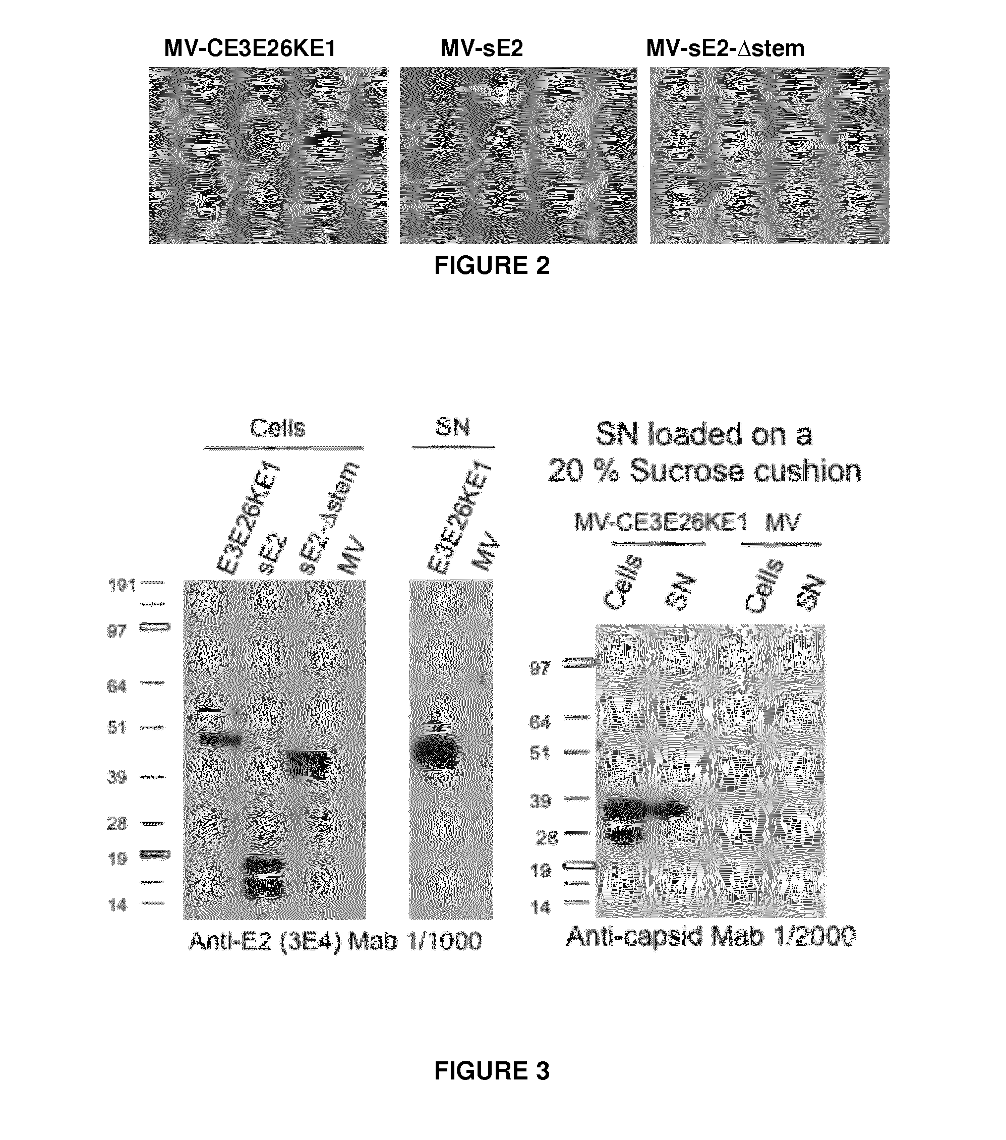 Recombinant measles virus expressing chikungunya virus polypeptides and their applications