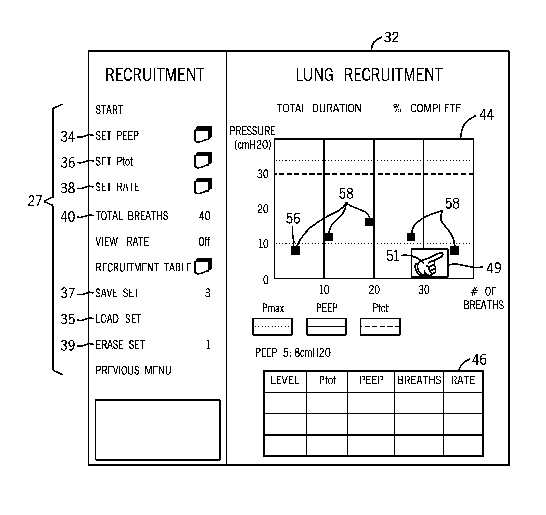 Device and method for graphical mechanical ventilator setup and control