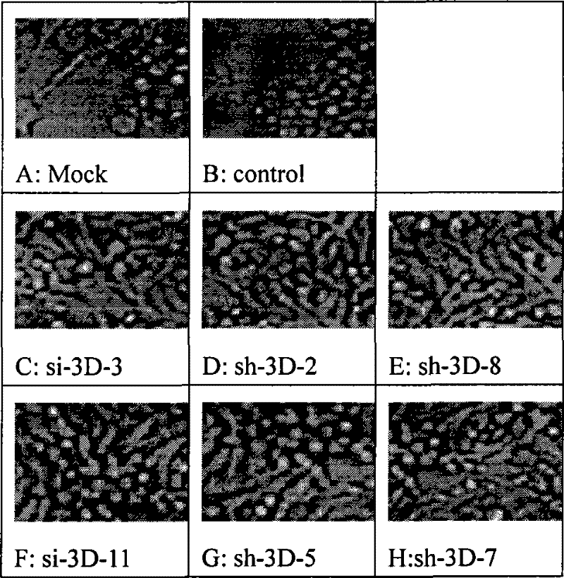 Spray containing small molecule disturbance ribonucleic acid