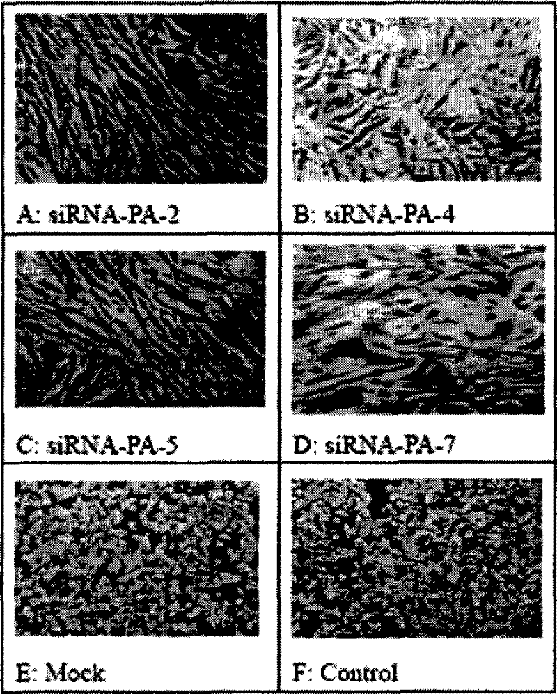 Spray containing small molecule disturbance ribonucleic acid