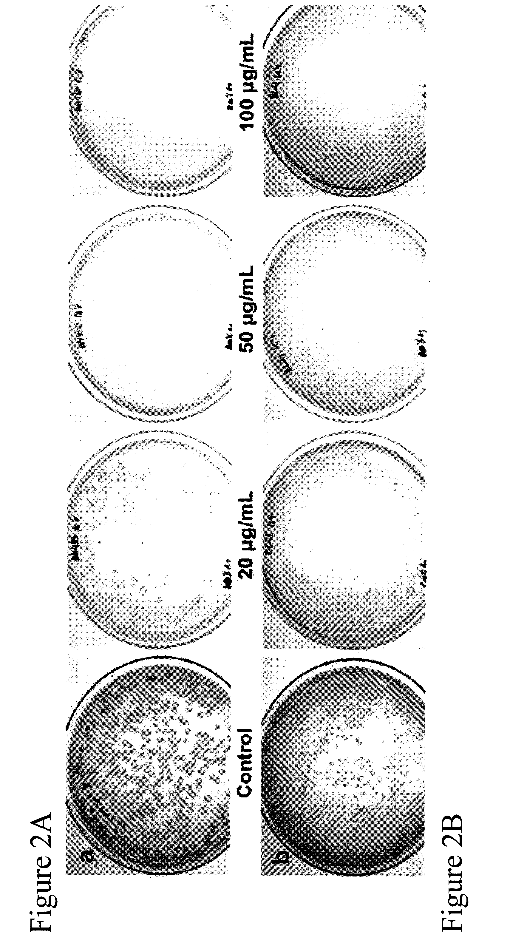 Structured silver-mesoporous silica nanoparticles having antimicrobial activity