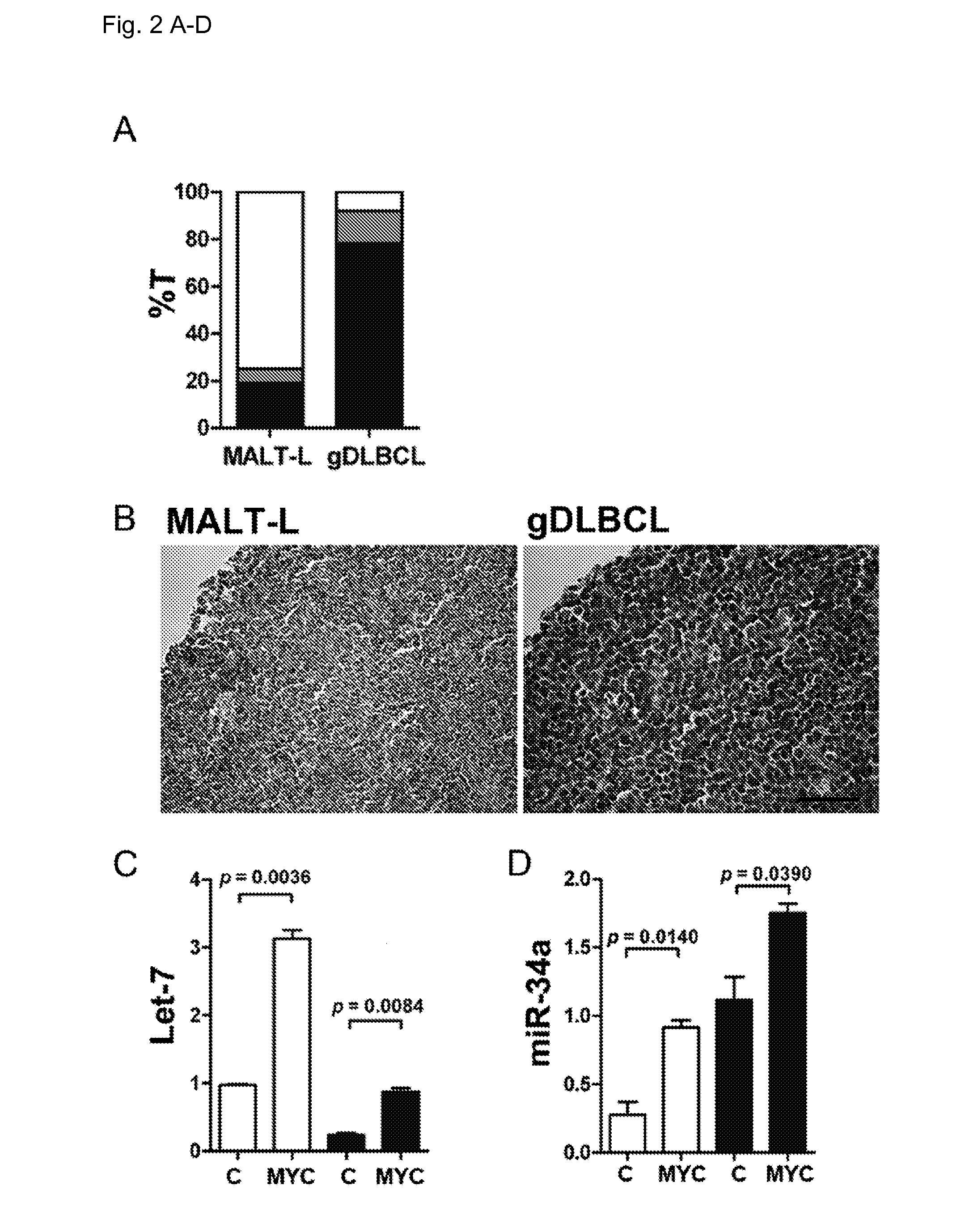 Treatment of b-cell lymphoma with microrna