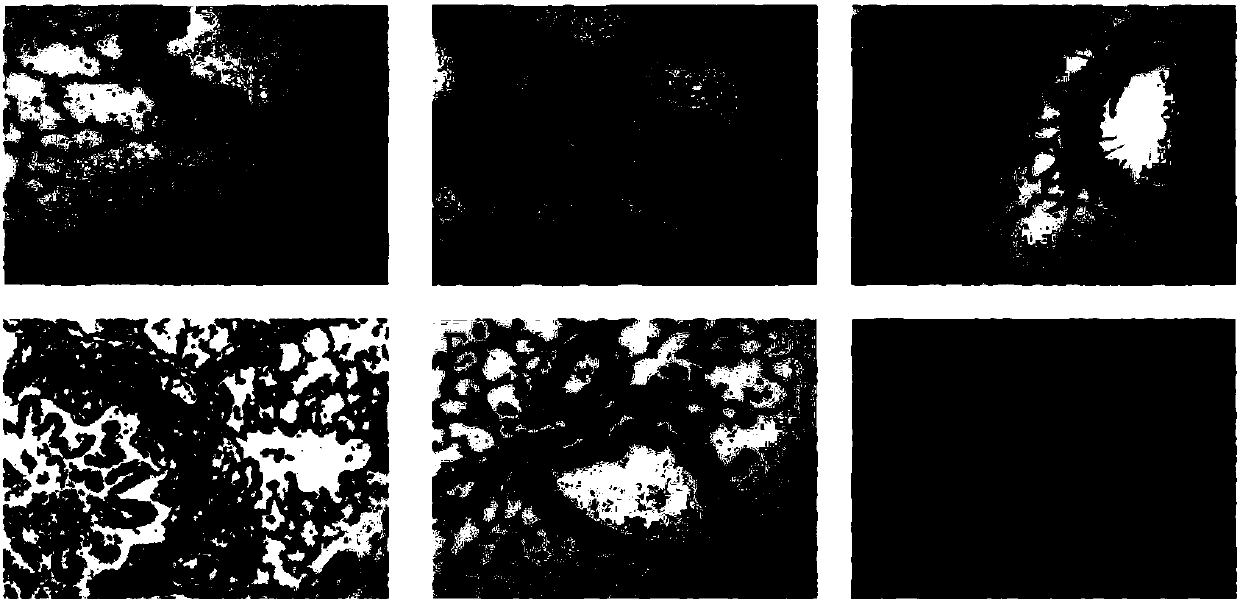 Pharmaceutical application of betaine for treatment of pulmonary arterial hypertension