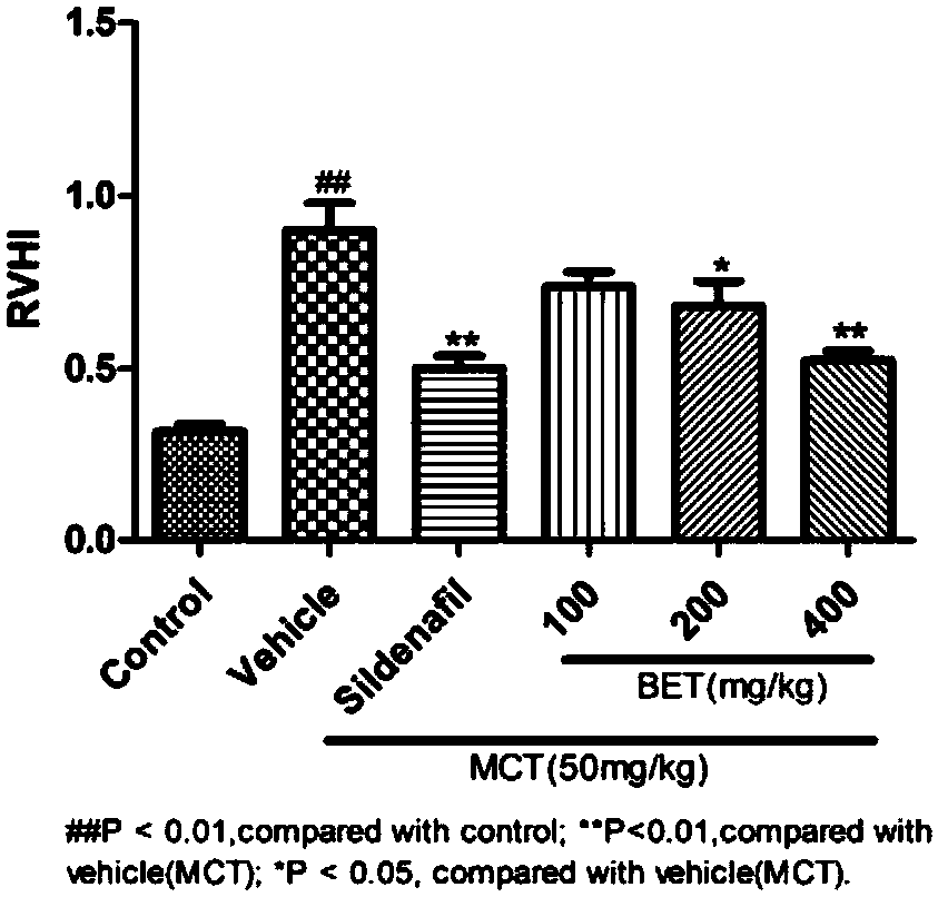 Pharmaceutical application of betaine for treatment of pulmonary arterial hypertension