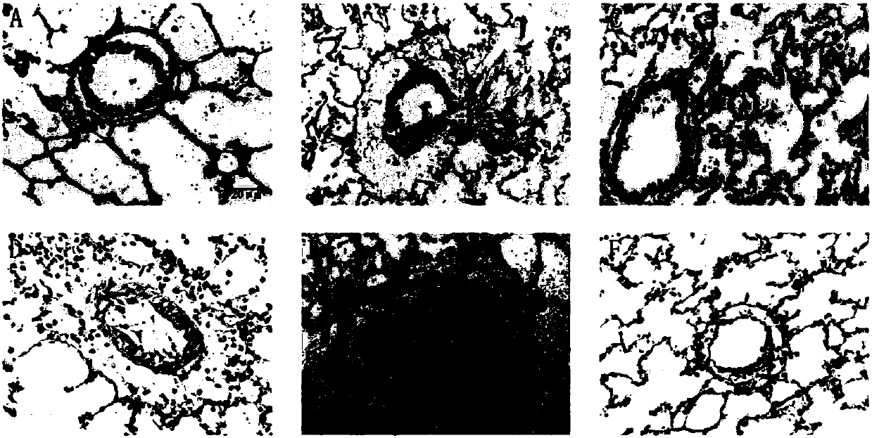 Pharmaceutical application of betaine for treatment of pulmonary arterial hypertension