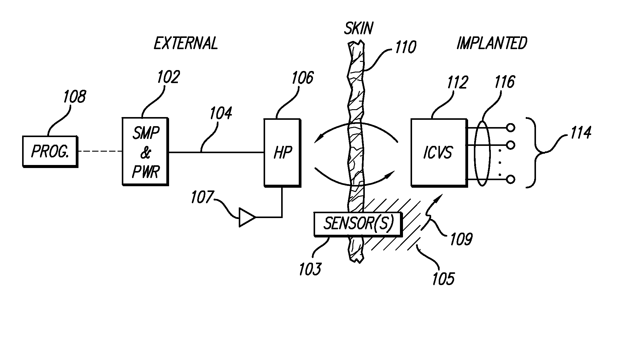 Dual Cochlear/Vestibular Stimulator with Control Signals Derived from Motion and Speech Signals