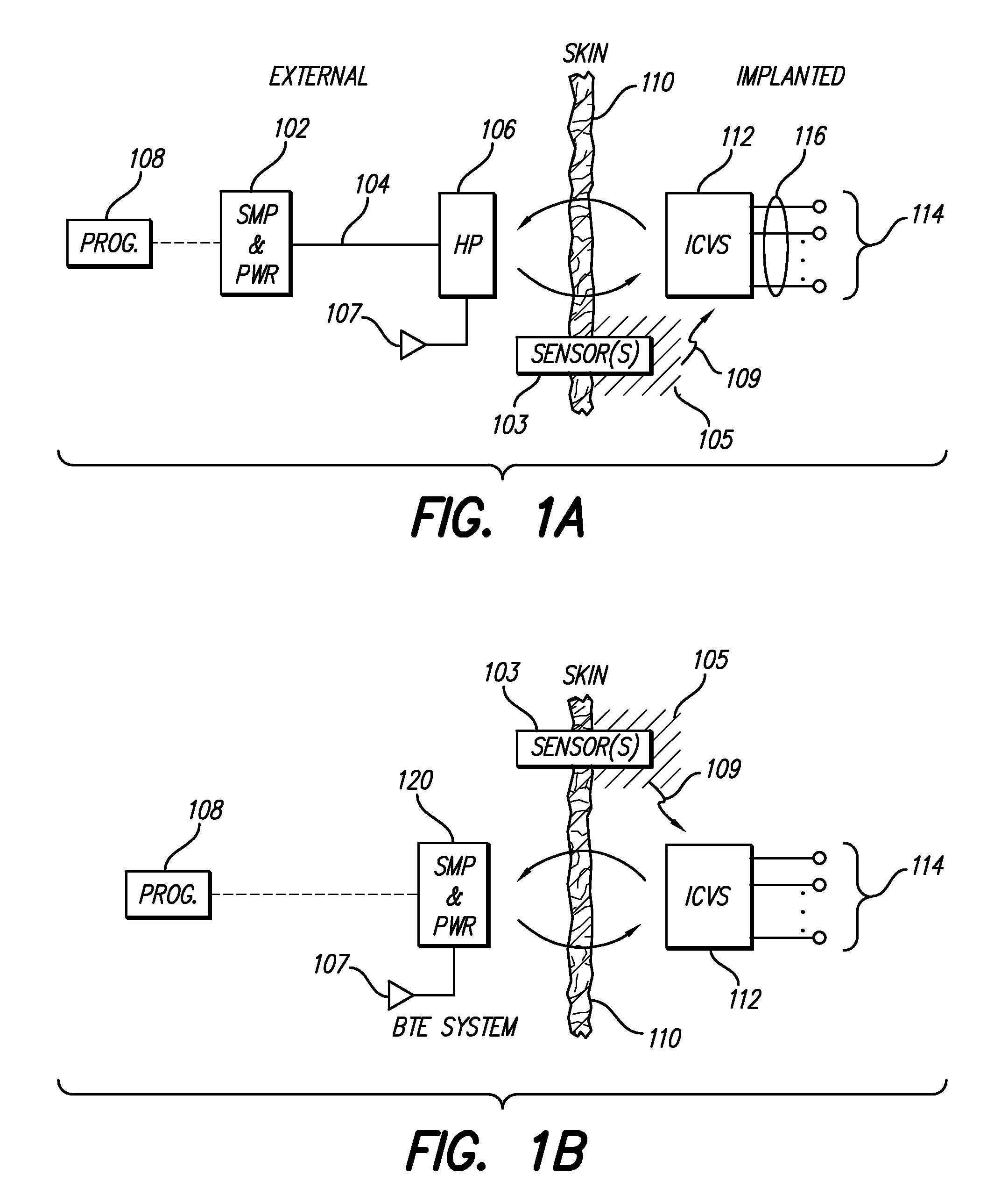 Dual Cochlear/Vestibular Stimulator with Control Signals Derived from Motion and Speech Signals