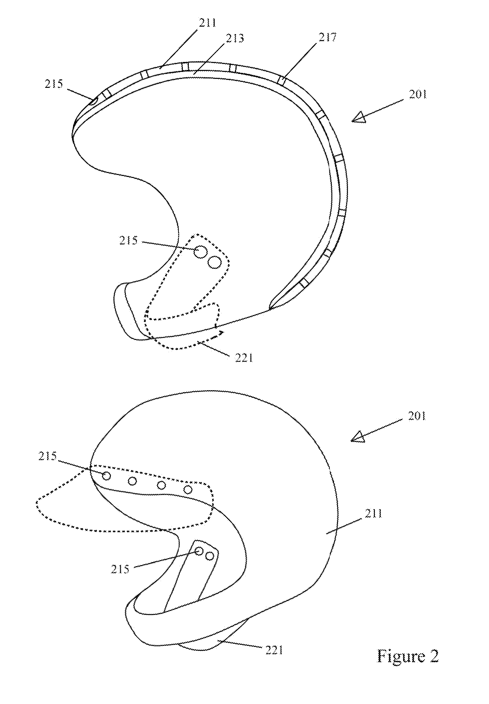 Shear reduction mechanism