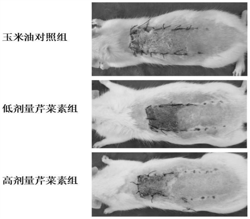 Effect of apigenin in preparation of medicine for promoting survival of ischemic random flap