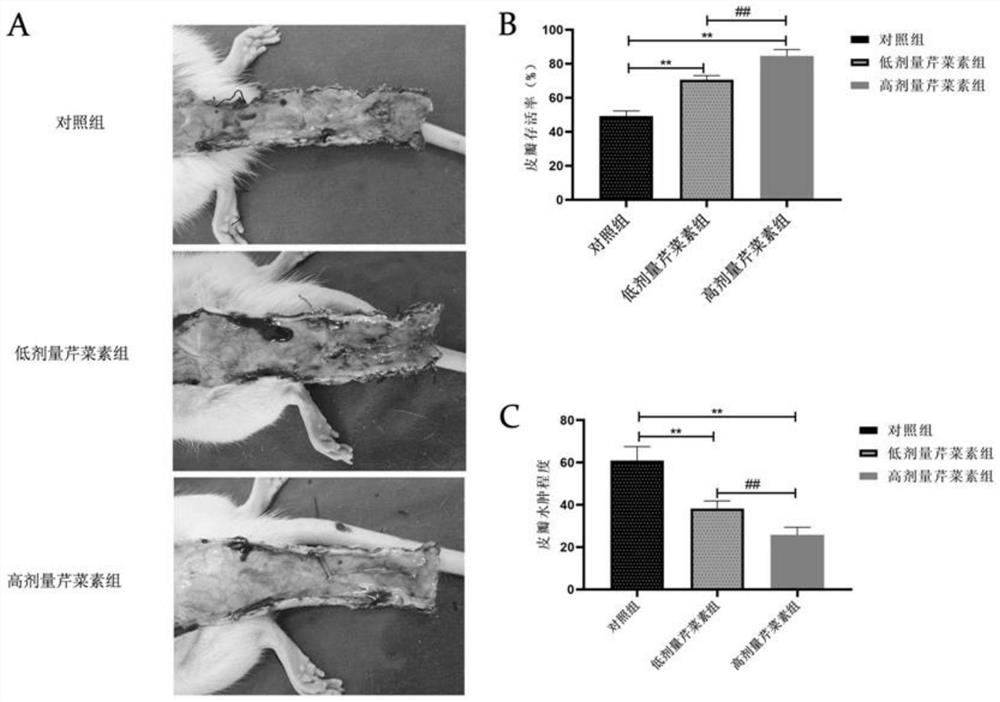 Effect of apigenin in preparation of medicine for promoting survival of ischemic random flap