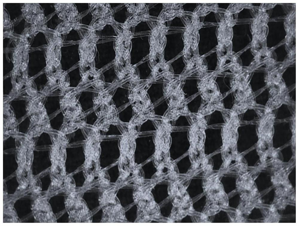 Soft tissue repair stent and preparation method thereof