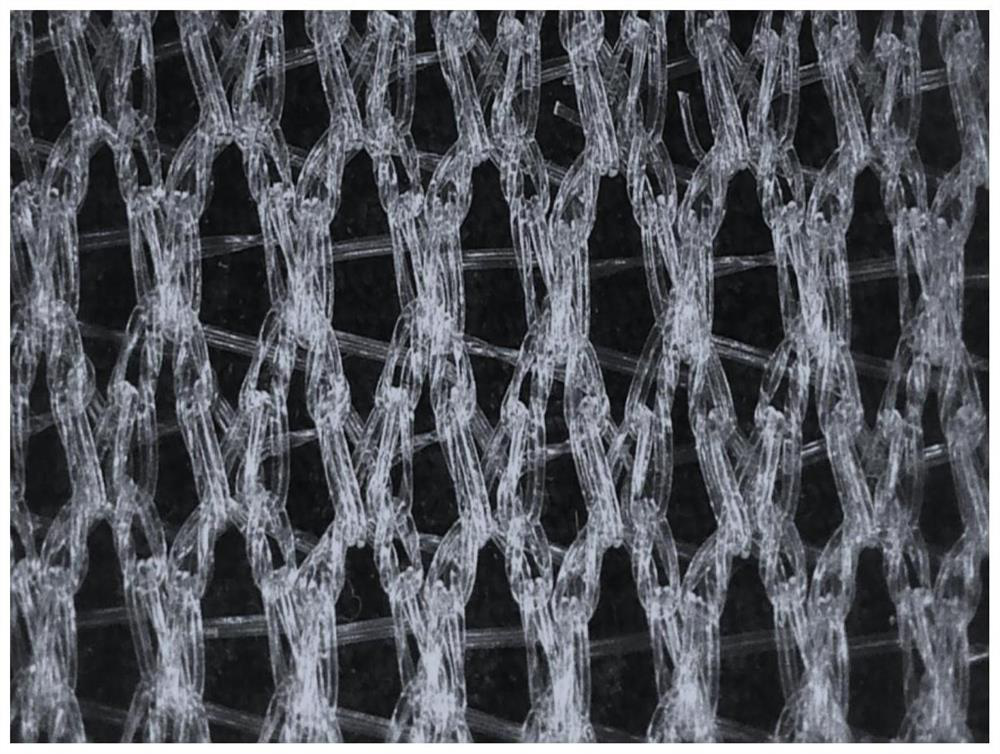 Soft tissue repair stent and preparation method thereof