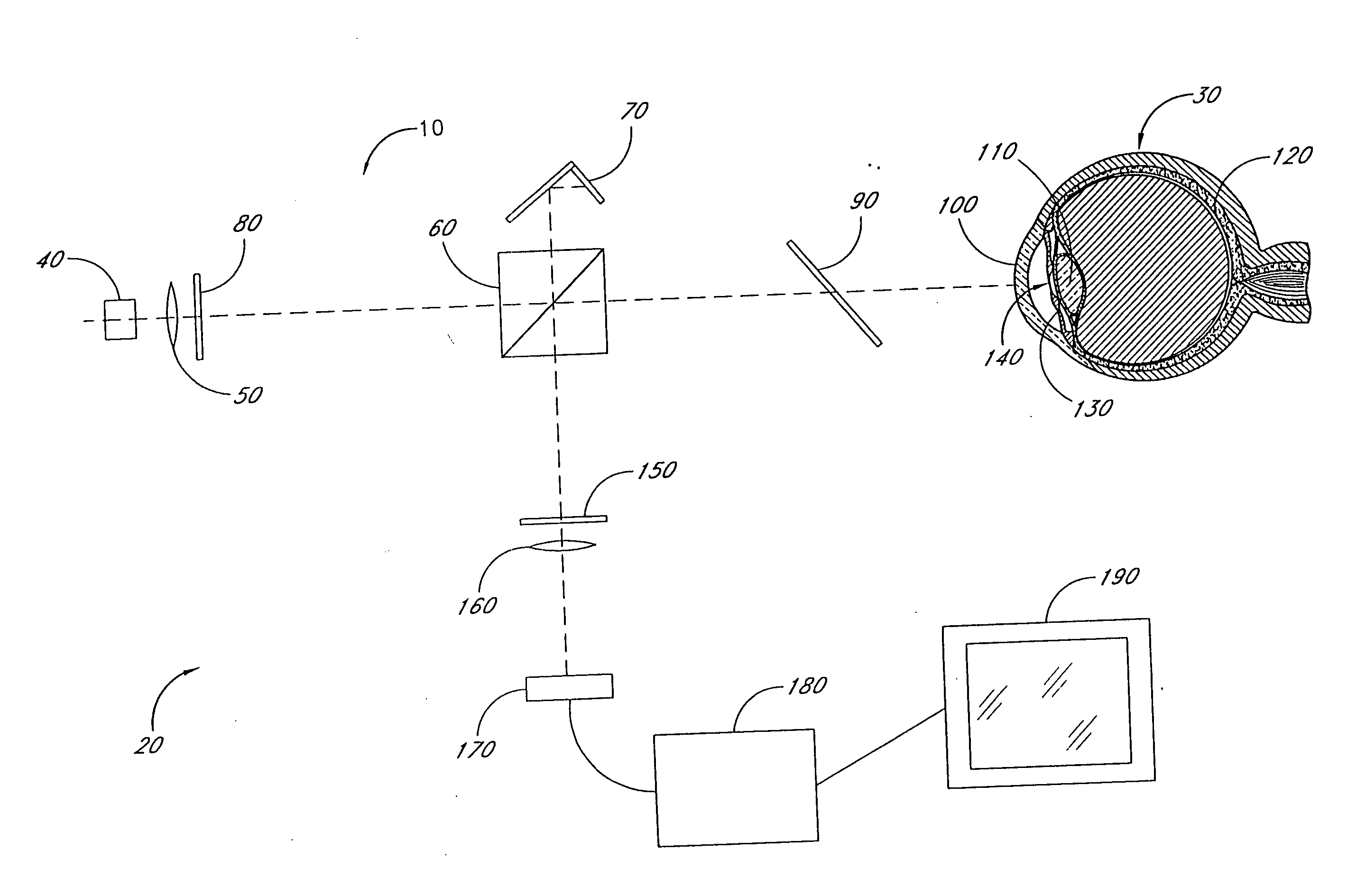 Cataract imaging apparatus