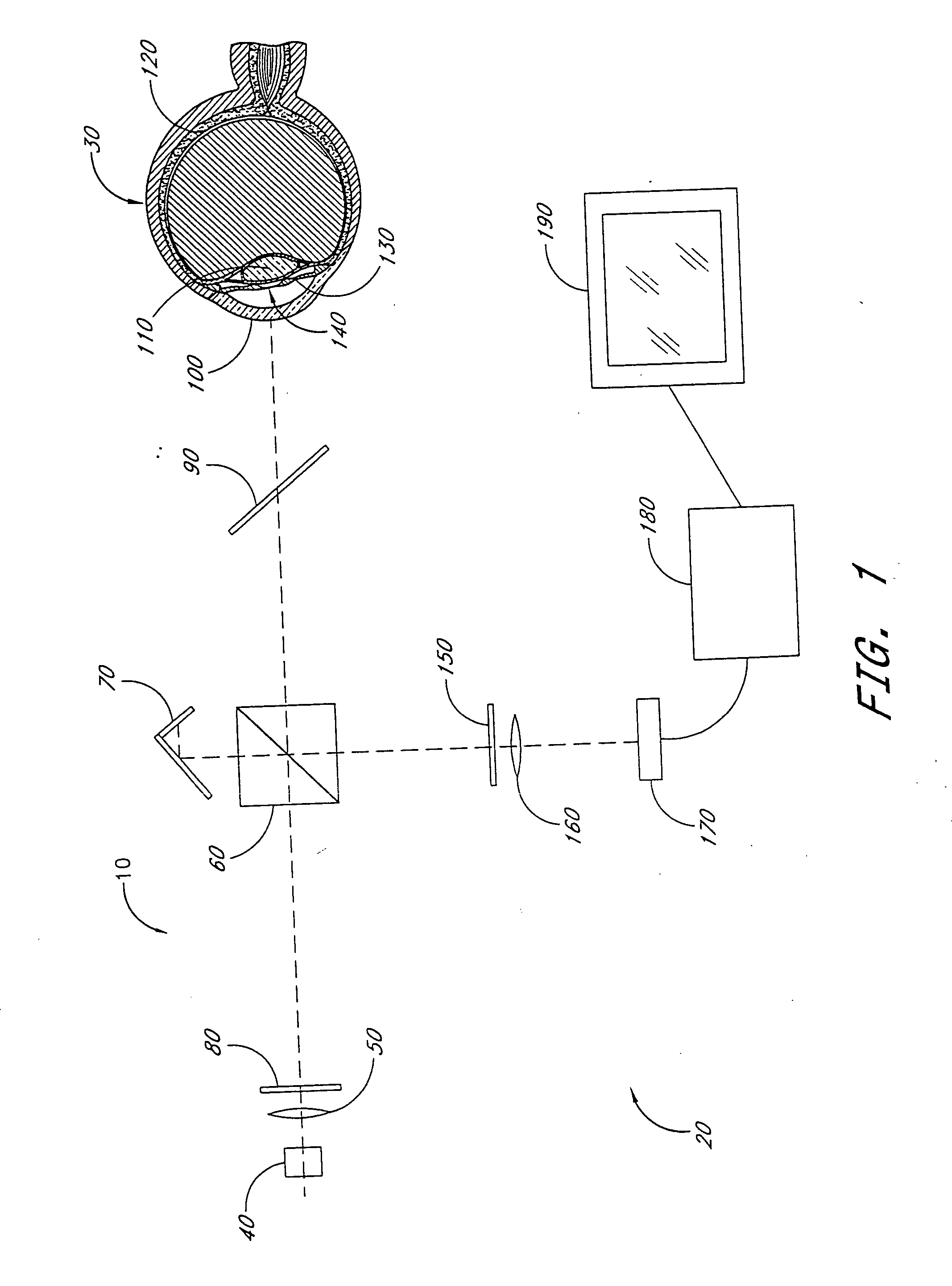 Cataract imaging apparatus