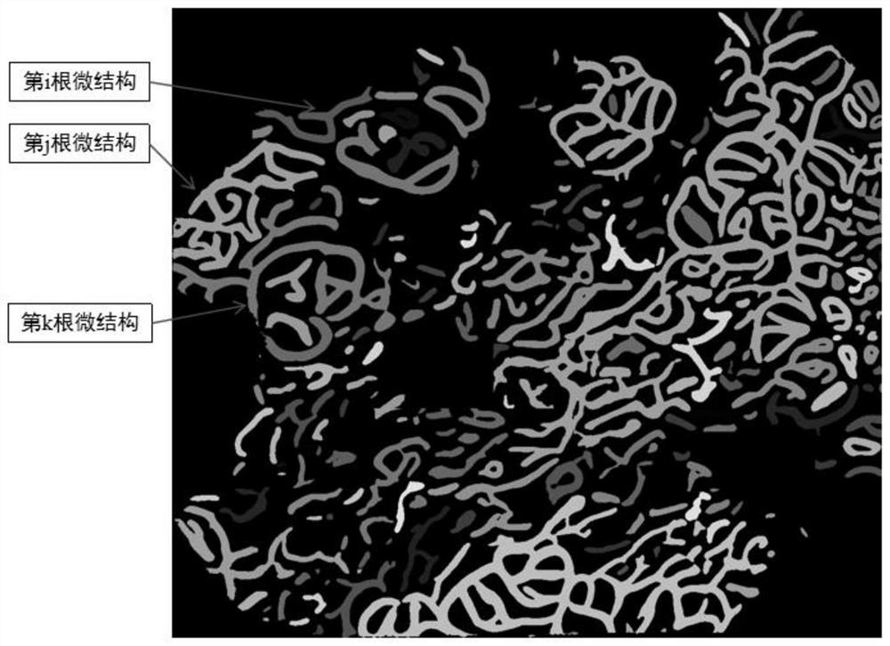 Abnormal degree quantification method of gastric mucosa dyeing magnified image microstructure