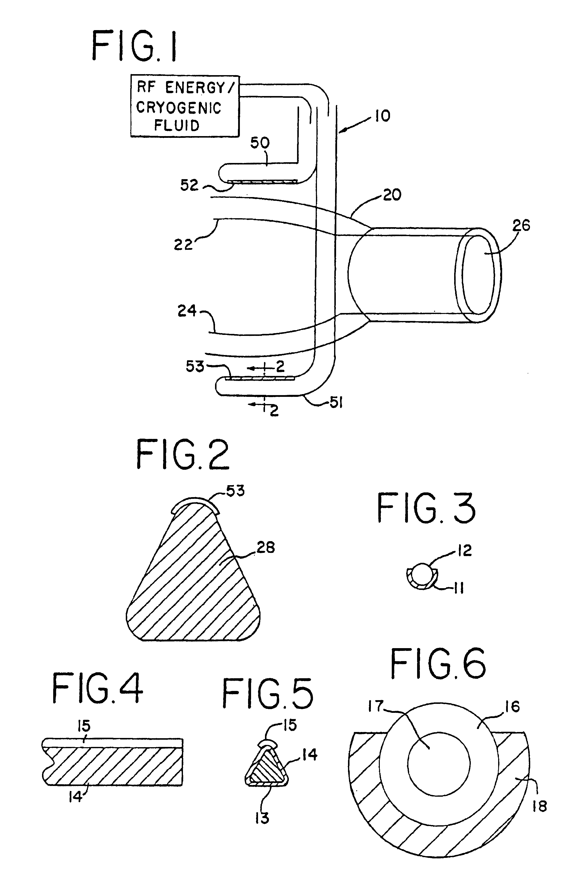 Transmural ablation device