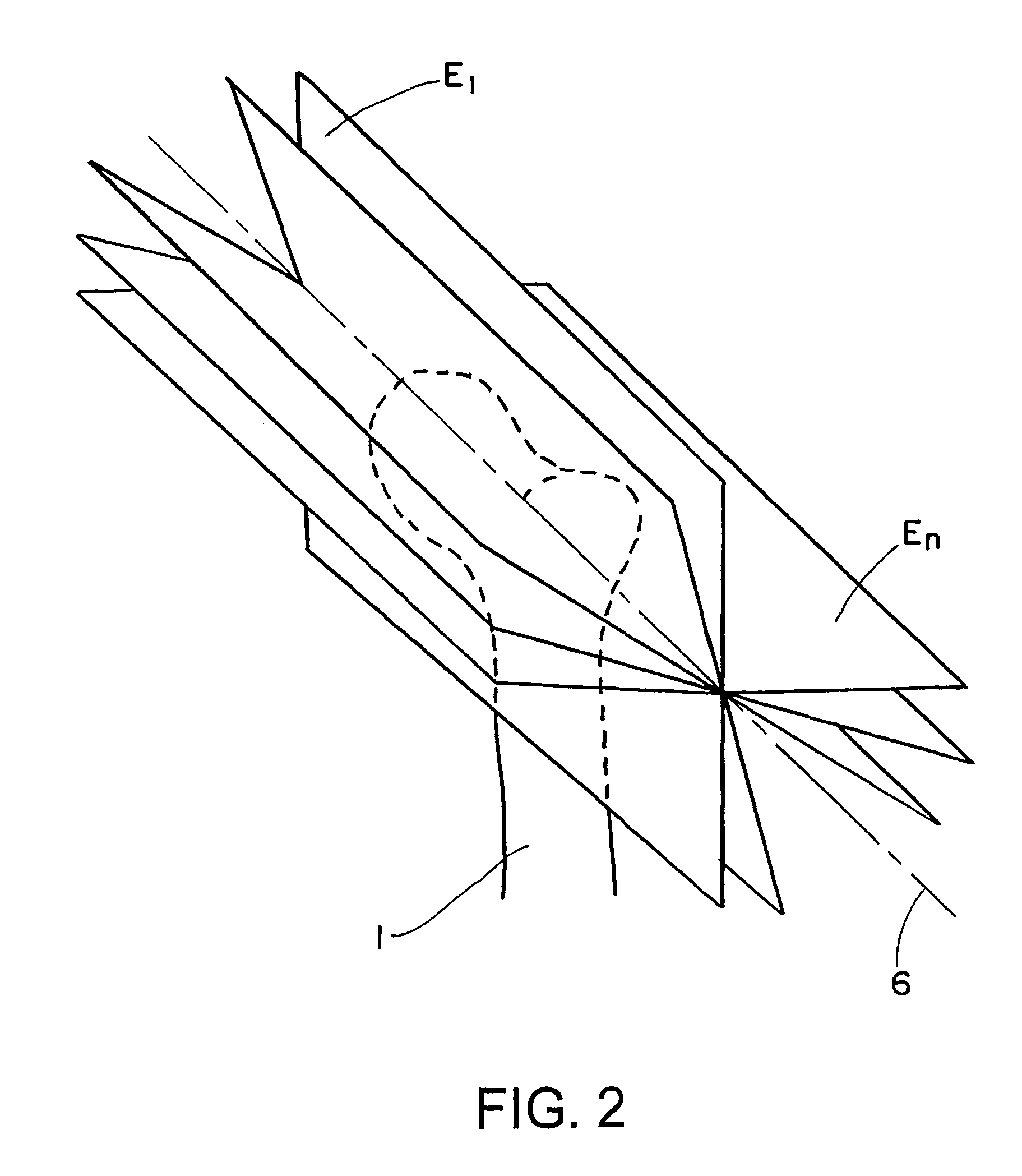 Computer-assisted planning method for correcting changes in the shape of joint bones