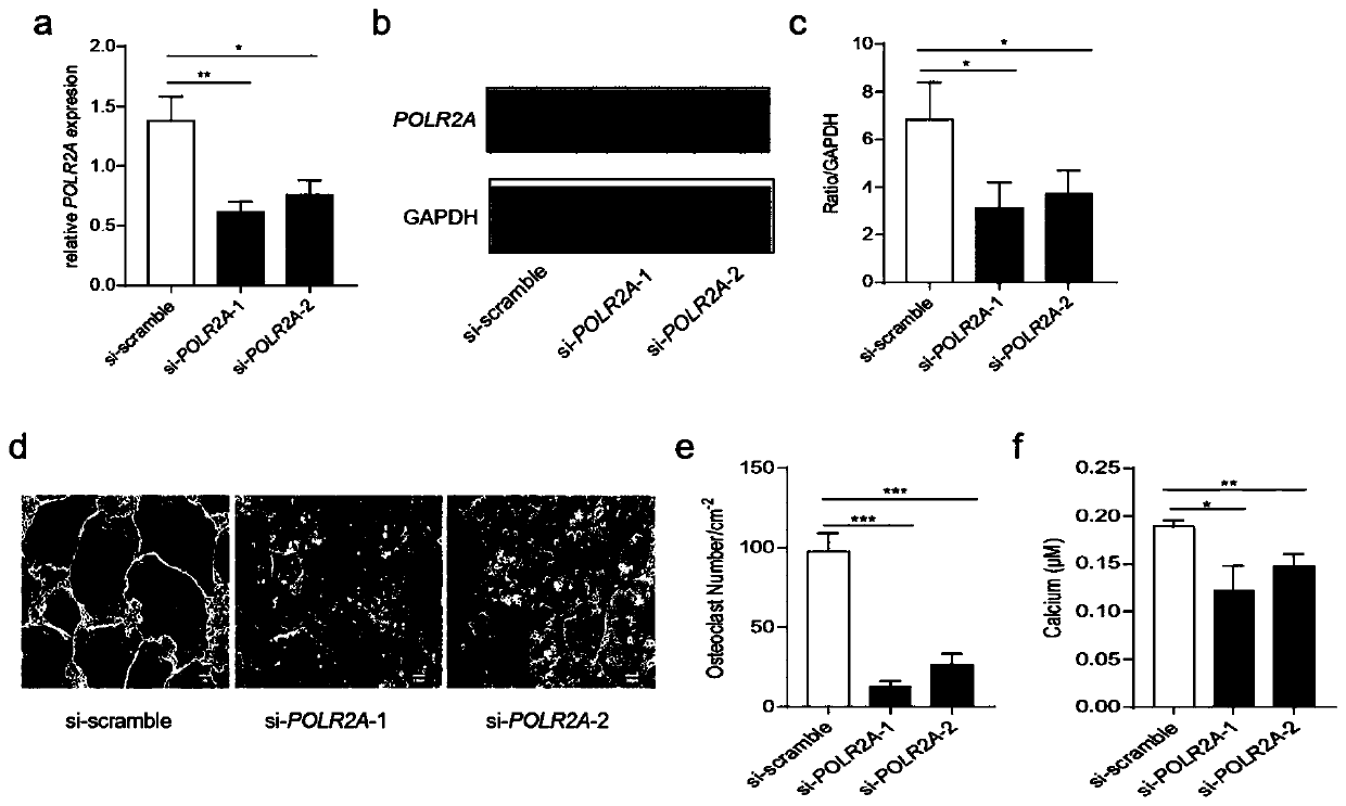 Application of POLR2A inhibitor in preparation of medicine