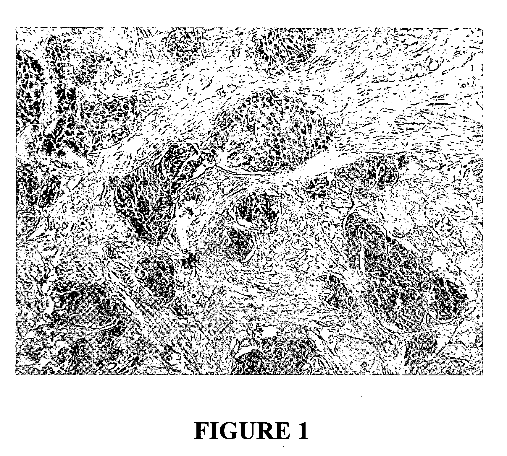 Treatment of cancer using TLR3 agonists