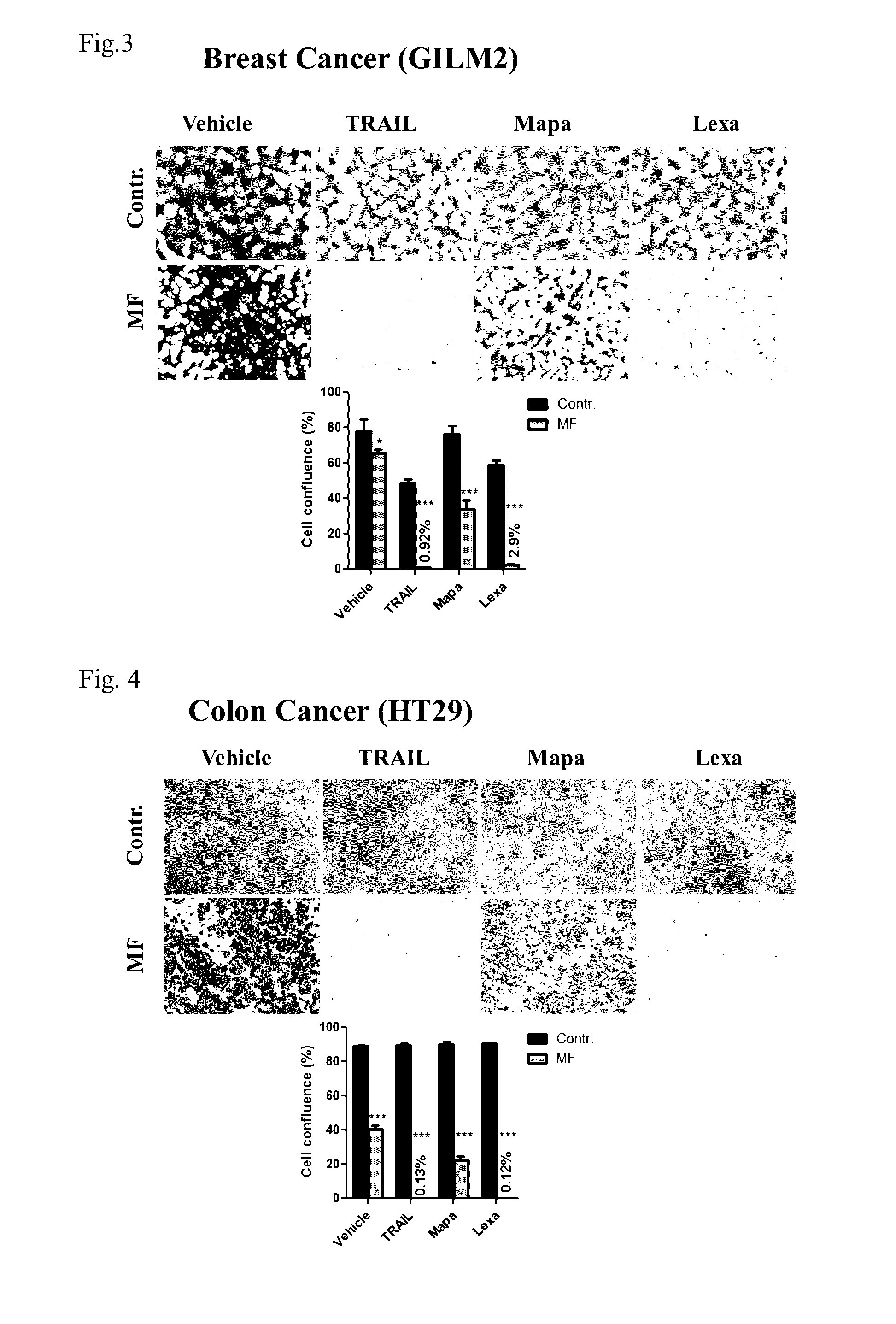 Combination cancer treatment