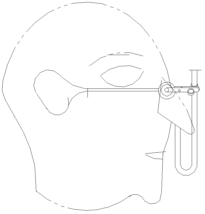 Fully rigid fixing bracket supported on nose for trachea intubation