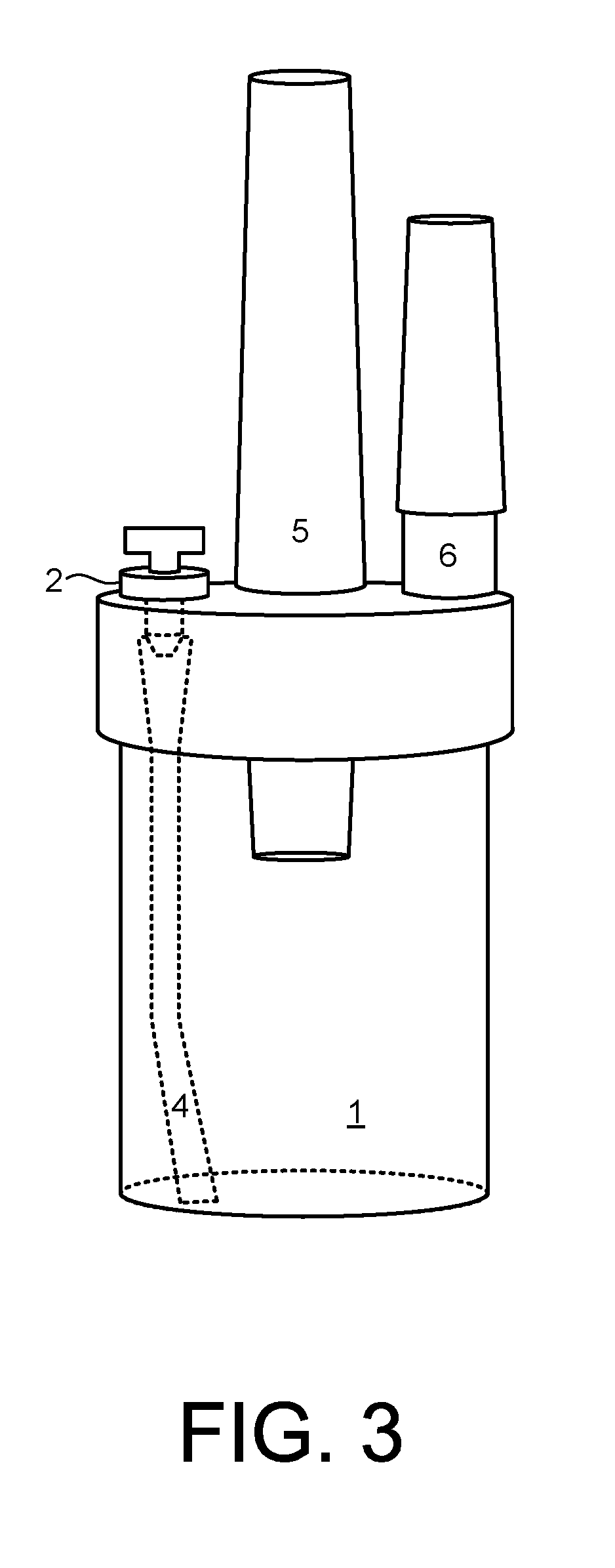 Collection of amniotic fluid for wound healing