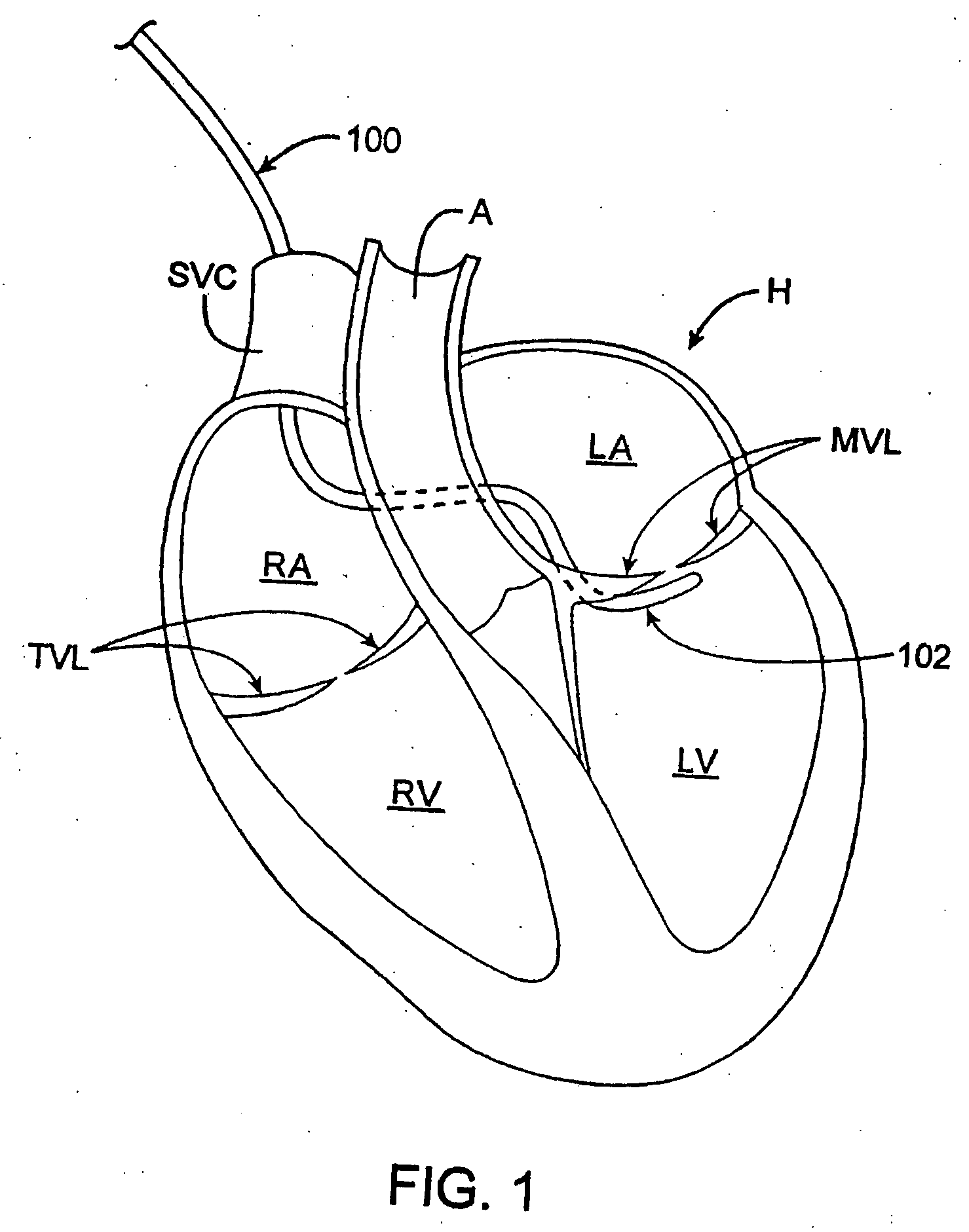 Methods and devices for termination