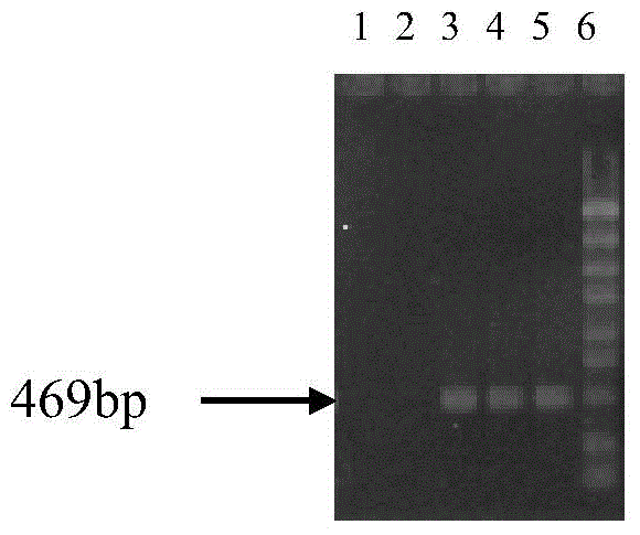 Nested RT-PCR primer group, detection method and kit for CYVCV