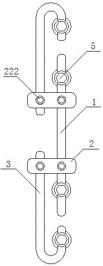 Extending tension type non-fusion fixation system