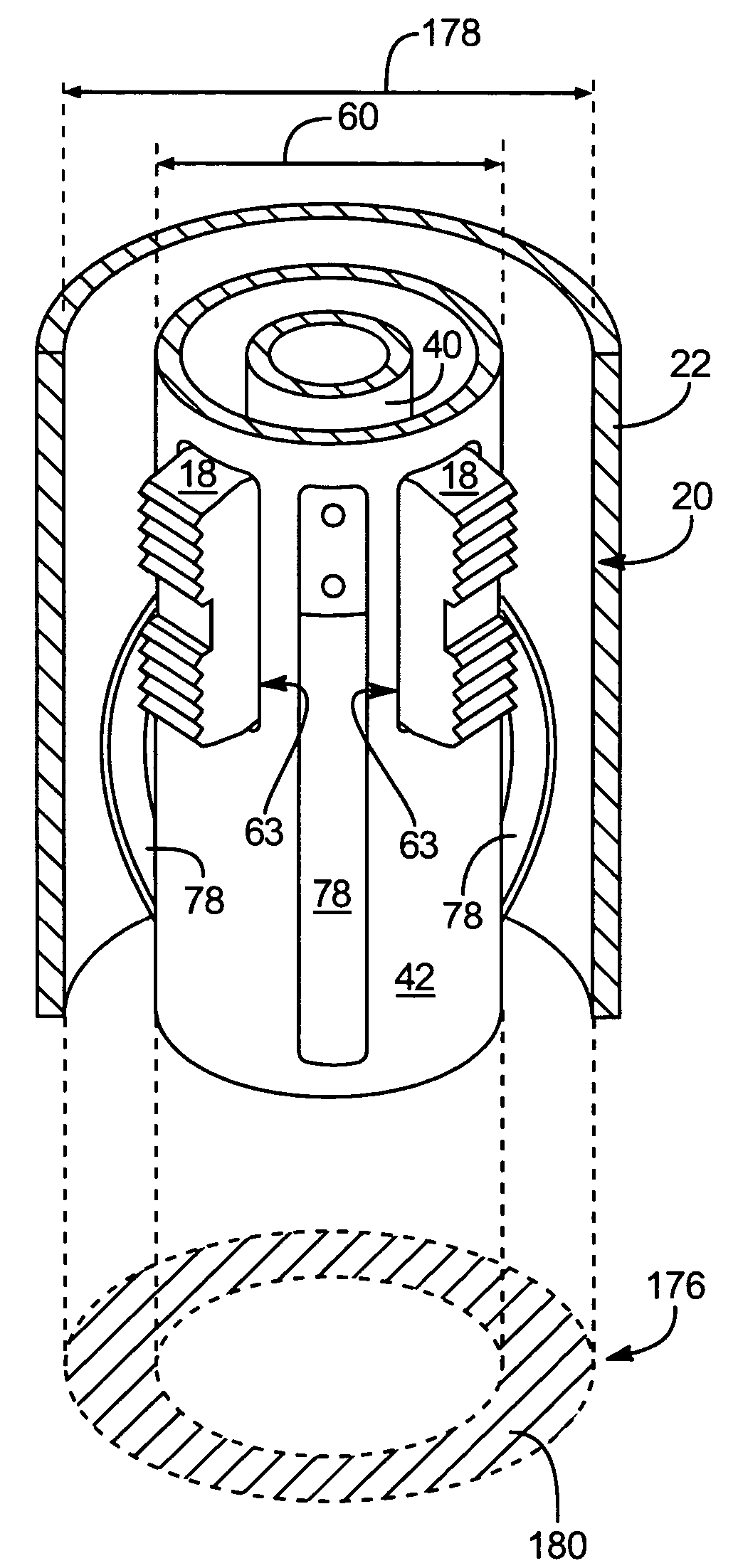 Hydrodynamic, down-hole anchor