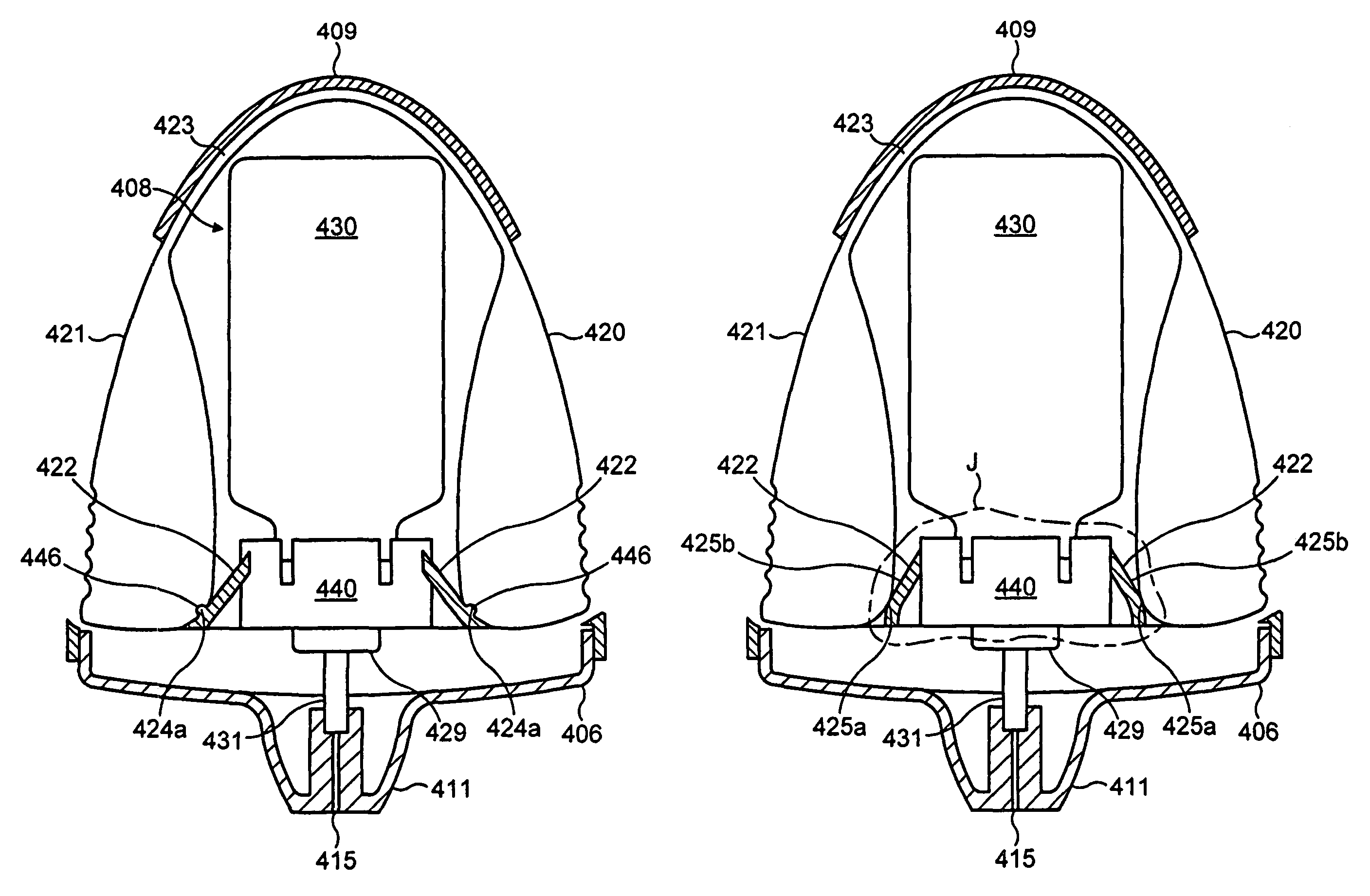 Fluid dispensing device