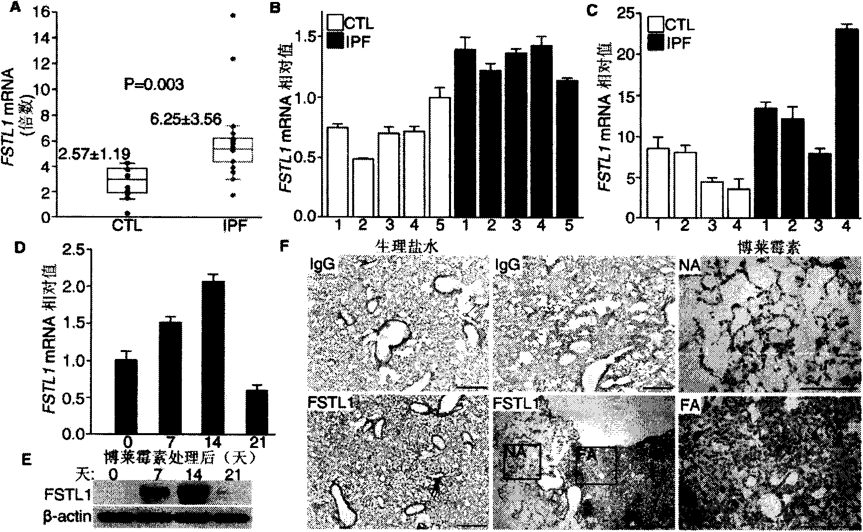 Monoclonal antibody of follistatin-like protein l and application thereof